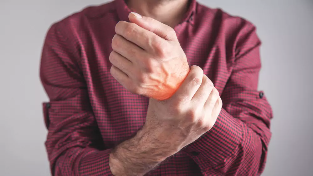 Rheumatoid Arthritis