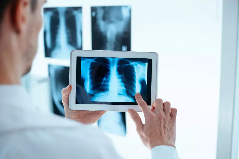Digital X-Ray